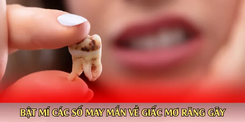 Bật mí các số may mắn về giấc mơ răng gãy